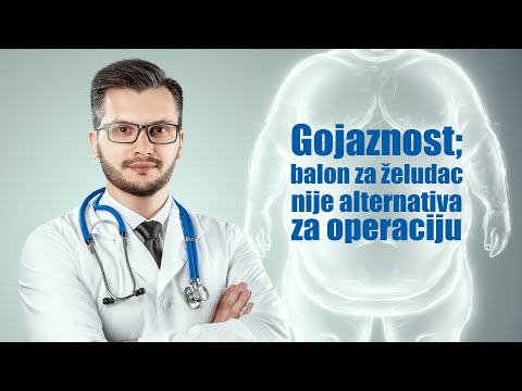 Gojaznost: balon za želudac nije alternativa za operaciju