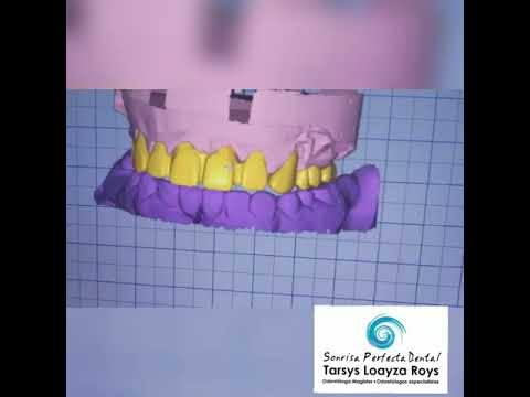 High-tech dentistry in Cartagena, Colombia at Sonrisa Perfecta Dental - Tarsys Loayza