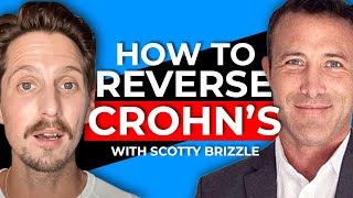 Reversing Crohn's Disease with the Carnivore Diet!
