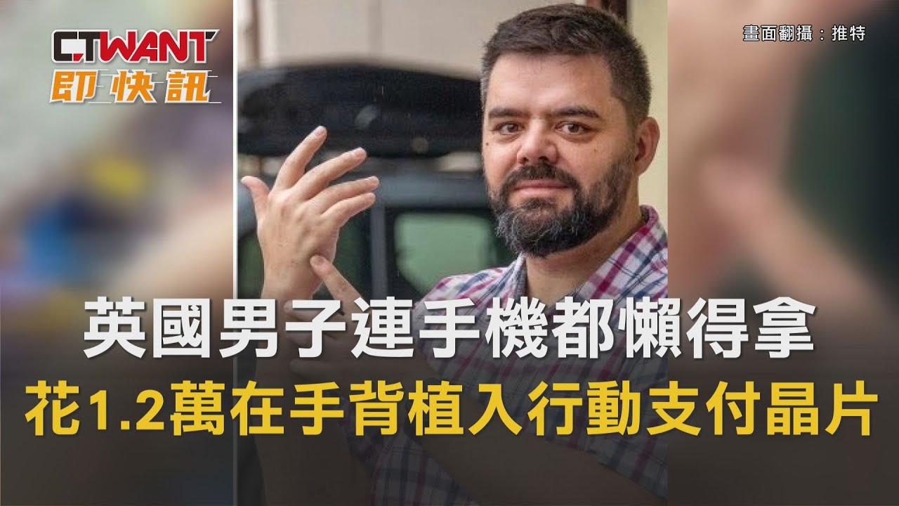 圖說-英國男子連手機都懶得拿　花1.2萬在手背植入行動支付晶片