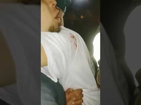 ASI QUEDÓ EL ROSTRO DE REMIK GONZÁLEZ DESPUÉS DE SU PELEA CON MENACE WP. (2021)