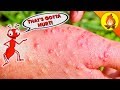 HANDS get DESTROYED by Fire Ants!