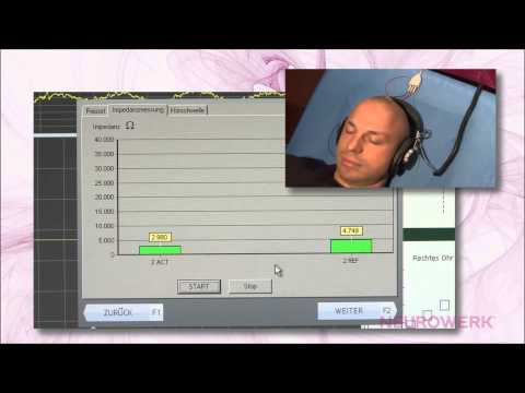 Evozierte Potentiale - AEP