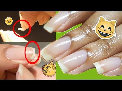 Therapeutic ahente laban fungus paa Kung paano sa pagalingin halamang-singaw sa thumb nail