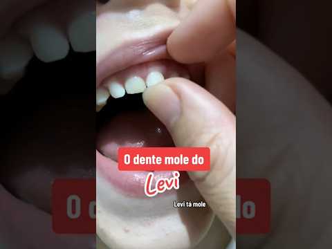 Levi's loose tooth #levi #tialéia #baixadasantista