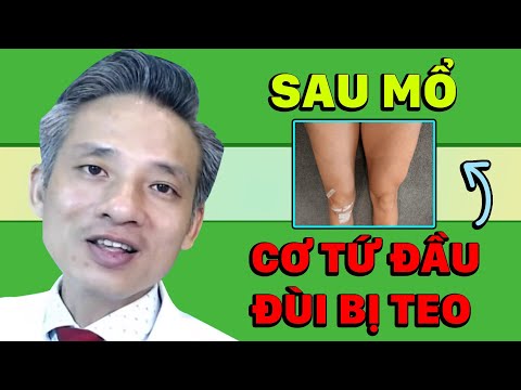 Teo cơ đùi sau mổ đứt dây chằng chéo trước xử lý thế nào!? | Bác sĩ Thể thao Nguyễn Trọng Thuỷ