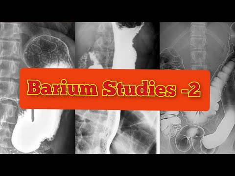 Radiology Viva Cases # 131-136 | Barium  Studies Part - 2 #medical #radiology #ultrasound #doppler