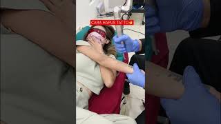 Download lagu The Most Effective Way to Remove Tattoos in 2022 #tattooremoval #lasertattooremoval #sulamalisrosidi mp3