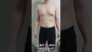 여유증흉터 고민?? 실루엣은 5mm 절개로 유선조직 제거 여유증수술 끝~~ #여유증 #여유증지방흡입