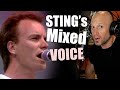 Unpacking STING S Incredible Performance Of Roxanne At Live Aid