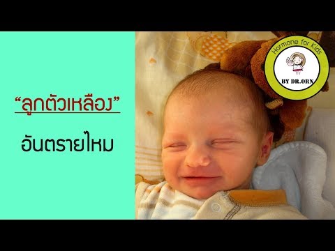 ในการรักษาโรคสะเก็ดเงินโรคสะเก็ดเงินภาพ ในการรักษาโรคสะเก็ดเงินและข้อต่อ
