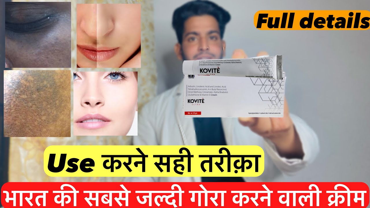 Kovite ultra cream | Kovite ultra cream review | Kovite ultra cream uses | kovite ultra cream fayde