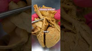 Download lagu Heart Attack: This is the Cause mp3