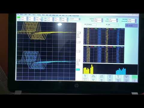 EMG Machine - Electromyograph Latest Price, Manufacturers & Suppliers