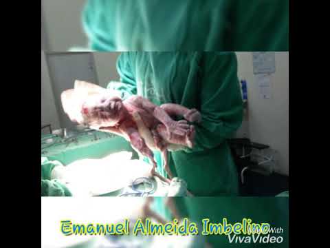 Emanuel Almeida Imbelino