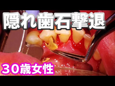 【閲覧注意】海外で3500万回再生された「日本のグロ動画」、凄すぎる（動画あり） - ポッカキットポッカキット