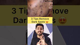 Remove Dark Spots, Pimple Marks From Face #darkspots #skincare #tips #shorts