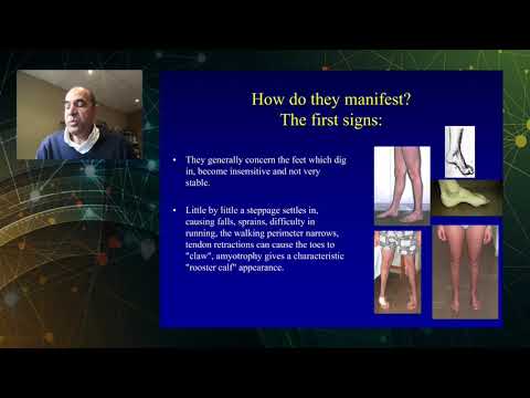 Charcot-Marie-Tooth disease - neurological aspects, Professor Shahram Attarian (MD, PhD)