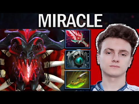 Bloodseeker Dota 2 Gameplay Ana with 24 Kills - Basher