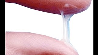 Brown, Yellow and white discharge Men Women | Types and Reasons