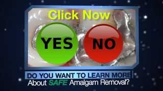 preview picture of video 'Safe Amalgam Removal - Holistic Dentist In Delray Beach'
