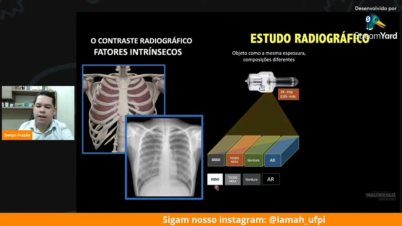 RADIOGRAFIA DO TÓRAX