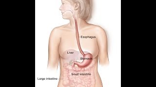 Stomach Cancer Simplified
