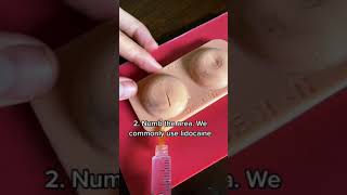 ABSCESS DRAINAGE