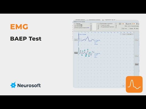 EMG: Short-latency auditory evoked potentials (BAEP test)