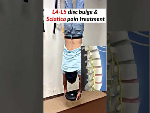 L4 - L5 disc bulge treatment &  sciatica pain treatment