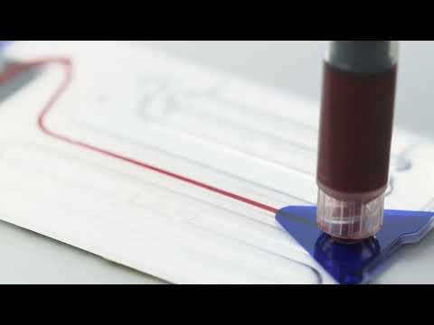 Epoc Blood. Gasometría en 30 segundos con punción digital