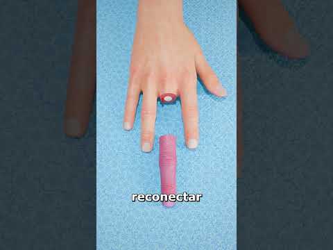 ¿Se Puede Reimplantar Un Dedo Amputado? 🤔
