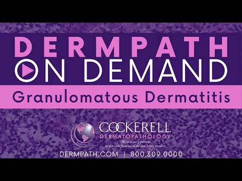 Granulomatous Dermatitis