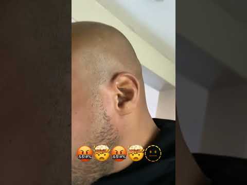 APPLE CIDER VINEGAR 👀👀👀               W/MOTHER  wowzer’a😳🔥💥 #bitters #guthealth #acv