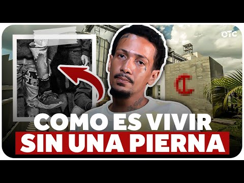 PERDER UNA PIERNA Y VER A MIS HIJOS HAMBRIENTOS ‘‘EL INFIERNO EN LA TIERRA’’ | OTRO CORO Podcast