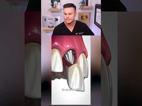 Why Your Bone DISAPPEARS If You Lose Adult Teeth! 😬🦷