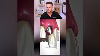 Why Your Bone DISAPPEARS If You Lose Adult Teeth! 😬🦷