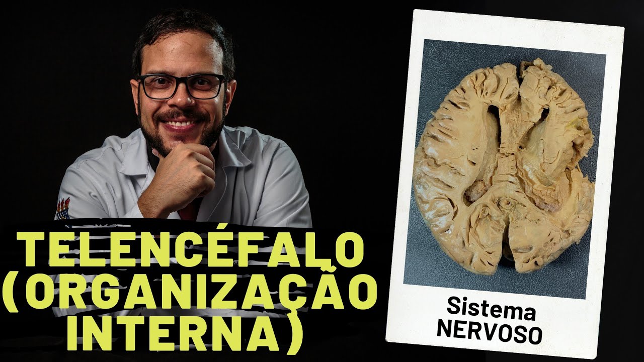 SISTEMA NERVOSO: TELENCÉFALO (ORGANIZAÇÃO INTERNA DO CÉREBRO) - AULA PRÁTICA