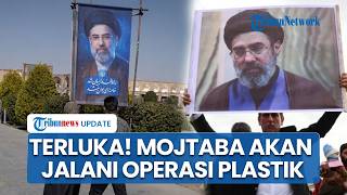 Update Kondisi Mojtaba Khamenei, Diklaim Bakal Pakai Kaki Palsu hingga Wajah akan Dioperasi Plastik