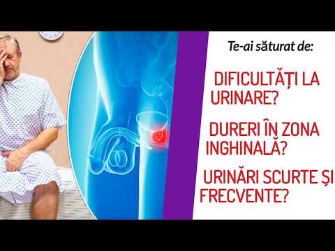 Es befasst sich in der Prostata Erotische Prostata-Massage wie es gemacht wird