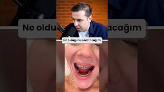 DİŞİNDEKİ MAVİ ŞEY NE ?