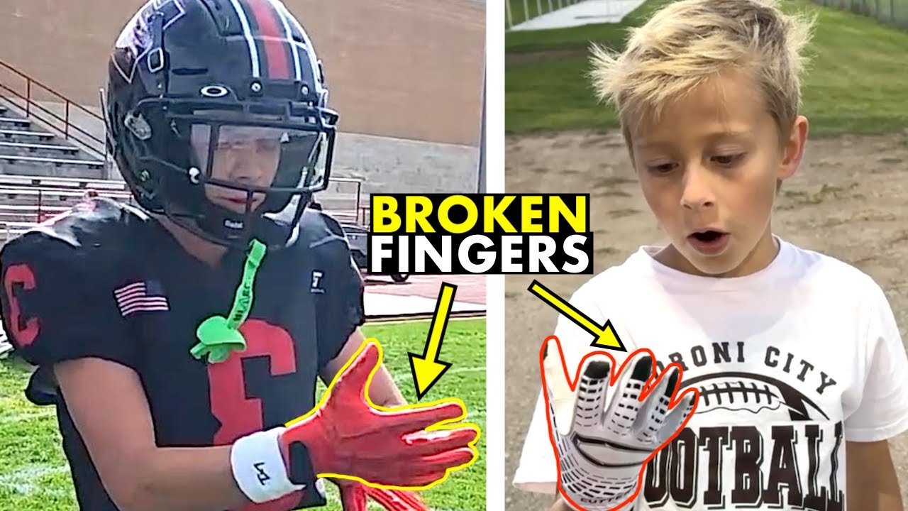 BROKEN FINGERS AT FOOTBALL GAMES! 🏈
