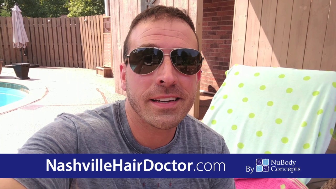 David B.'s Nashville Hair Doctor Experience