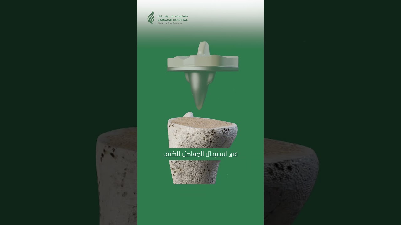 Dr. Muhammad Khalifa - Consultant Orthopedic head of department.