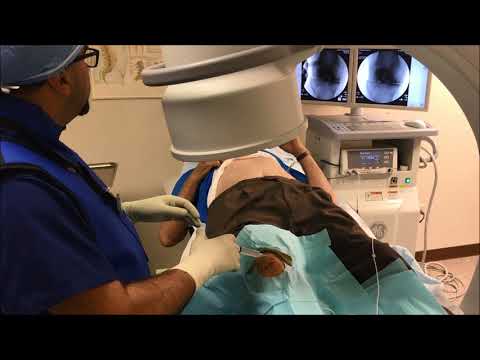 Genicular Nerve Ablation for knee pain