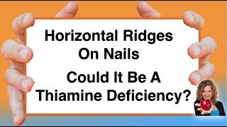 Could horizontal ridges on nails be a Thiamine deficiency? With Karen Langston