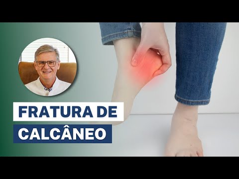 Fratura de Calcâneo (no Calcanhar) - Sintomas, Diagnóstico e Tratamento