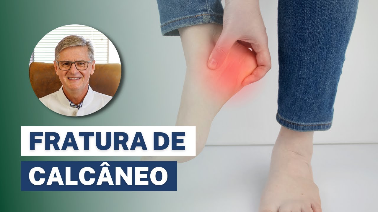 Fratura de Calcâneo (no Calcanhar) - Sintomas, Diagnóstico e Tratamento
