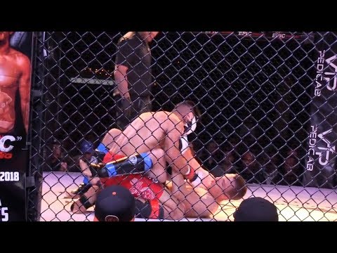 Why You Need More Than BJJ In MMA - Amateur MMA Fight (Epic Fighting)