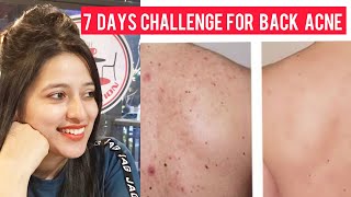How to get rid of Back Acne / Bacne Scars in 7 DAYS